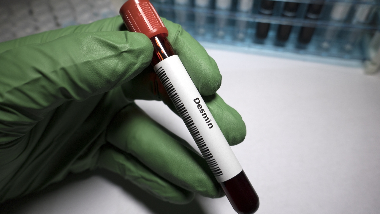 Soft Tissue Sarcoma & Bone Tumor Surgery